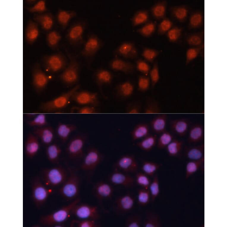 Immunofluorescence - Anti-CDK11B Antibody (A87847) - Antibodies.com