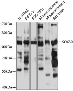 Western blot analysis of extracts of various cell lines, using Anti-SOX30 Antibody (A11759) at 1:1,000 dilution.
Secondary antibody: Goat Anti-Rabbit IgG (H+L) (HRP) (AS014) at 1:10,000 dilution.
Lysates / proteins: 25µg per lane.
Blocking buffer: 3% non-fat dry milk in TBST.
Detection: ECL Basic Kit (RM00020).
Exposure time: 3s.