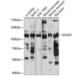 Western Blot - Anti-Sox30 Antibody (A87849) - Antibodies.com