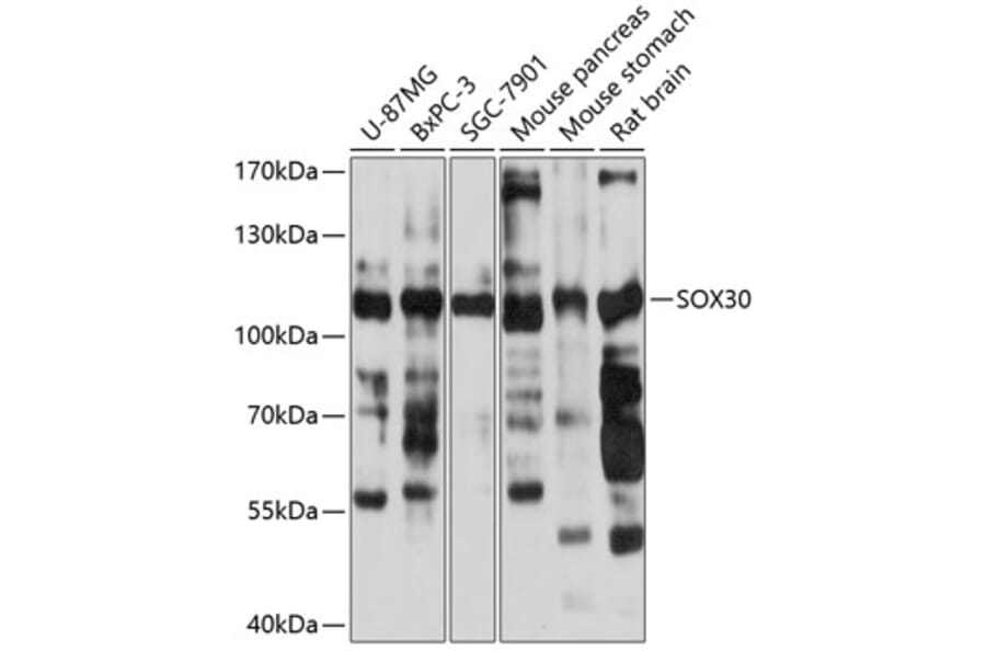 Western Blot - Anti-Sox30 Antibody (A87849) - Antibodies.com