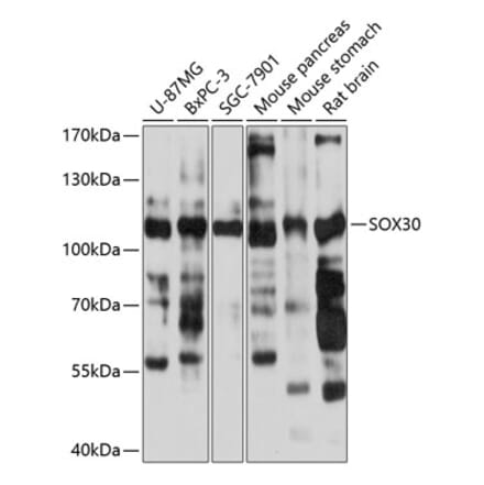 Western Blot - Anti-Sox30 Antibody (A87849) - Antibodies.com