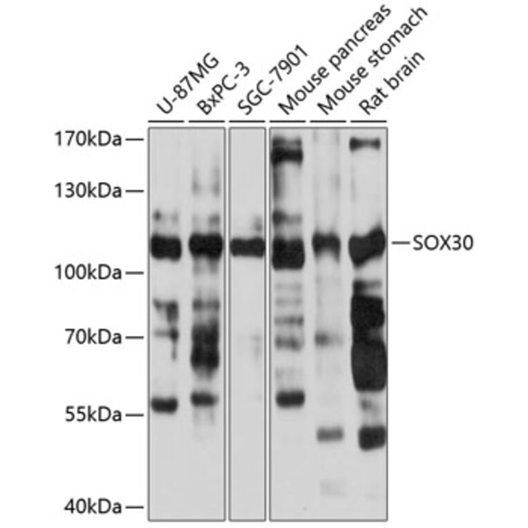 Western Blot - Anti-Sox30 Antibody (A87849) - Antibodies.com