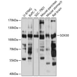 Western Blot - Anti-Sox30 Antibody (A87849) - Antibodies.com