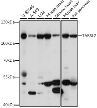 Western blot analysis of extracts of various cell lines, using Anti-TARSL2 Antibody (A15945) at 1:1,000 dilution.
Secondary antibody: Goat Anti-Rabbit IgG (H+L) (HRP) (AS014) at 1:10,000 dilution.
Lysates / proteins: 25µg per lane.
Blocking buffer: 3% non-fat dry milk in TBST.
Detection: ECL Basic Kit (RM00020).
Exposure time: 30s.