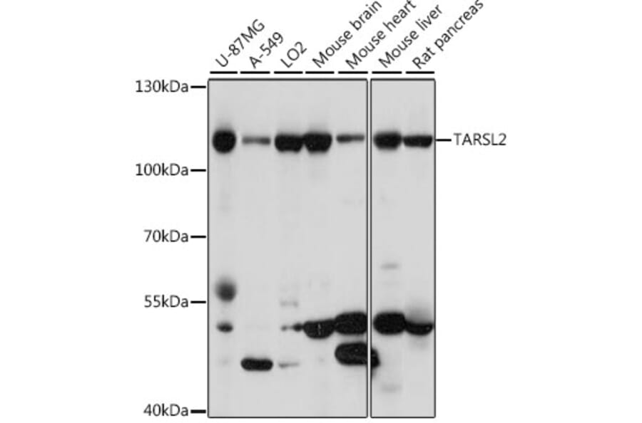 Western Blot - Anti-TARS3 Antibody (A87852) - Antibodies.com