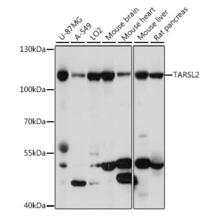 Western Blot - Anti-TARS3 Antibody (A87852) - Antibodies.com