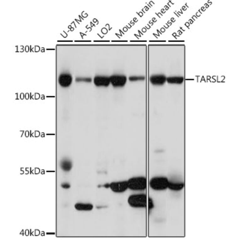 Western Blot - Anti-TARS3 Antibody (A87852) - Antibodies.com