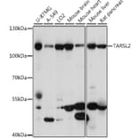 Western Blot - Anti-TARS3 Antibody (A87852) - Antibodies.com