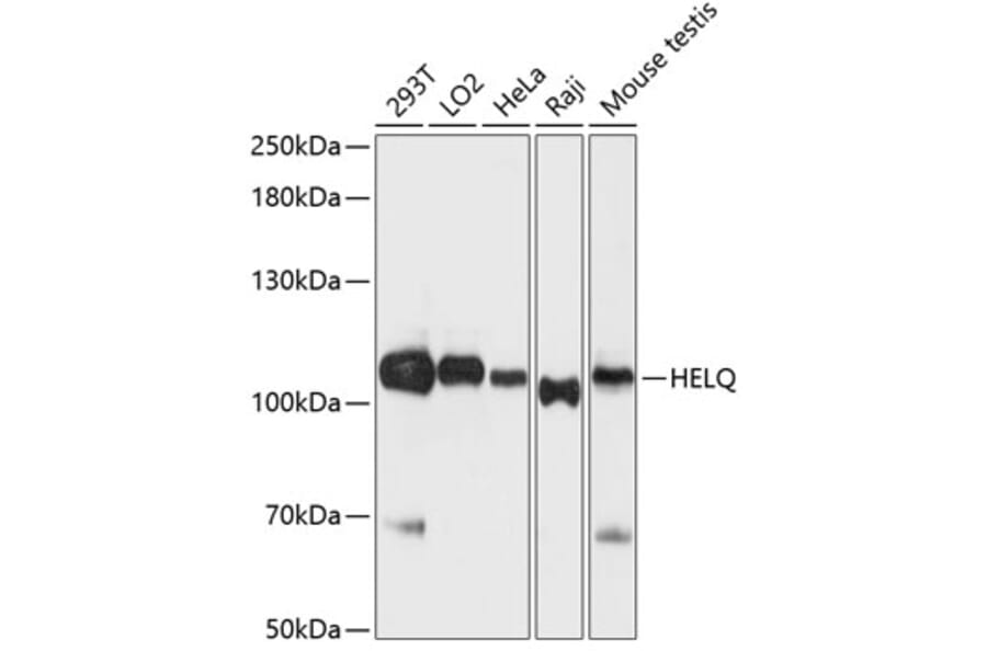 Western Blot - Anti-DNA helicase HEL308 Antibody (A87855) - Antibodies.com