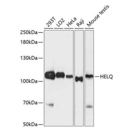 Western Blot - Anti-DNA helicase HEL308 Antibody (A87855) - Antibodies.com