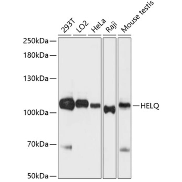Western Blot - Anti-DNA helicase HEL308 Antibody (A87855) - Antibodies.com