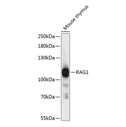 Western Blot - Anti-RAG1 Antibody (A87856) - Antibodies.com