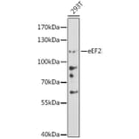 Western Blot - Anti-EEF2/Elongation factor 2 Antibody (A87857) - Antibodies.com