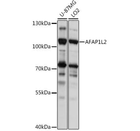 Western Blot - Anti-AFAP1L2 Antibody (A87858) - Antibodies.com