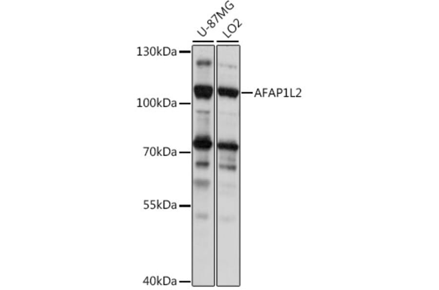 Western Blot - Anti-AFAP1L2 Antibody (A87858) - Antibodies.com