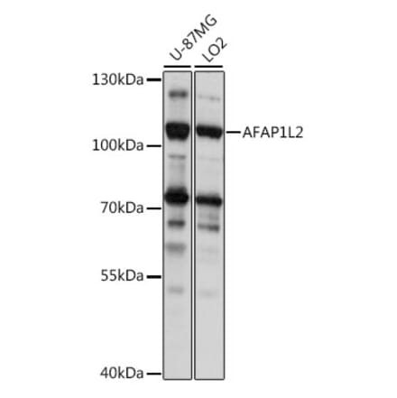 Western Blot - Anti-AFAP1L2 Antibody (A87858) - Antibodies.com