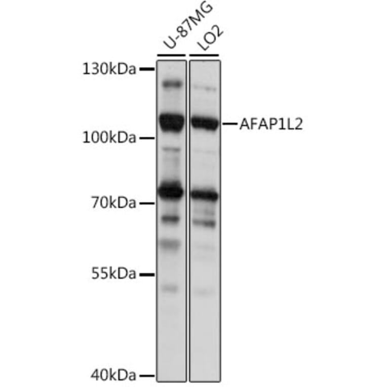 Western Blot - Anti-AFAP1L2 Antibody (A87858) - Antibodies.com