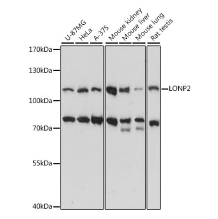 Western Blot - Anti-LONP2 Antibody (A87859) - Antibodies.com