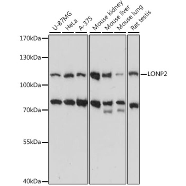 Western Blot - Anti-LONP2 Antibody (A87859) - Antibodies.com