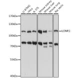 Western Blot - Anti-LONP2 Antibody (A87859) - Antibodies.com