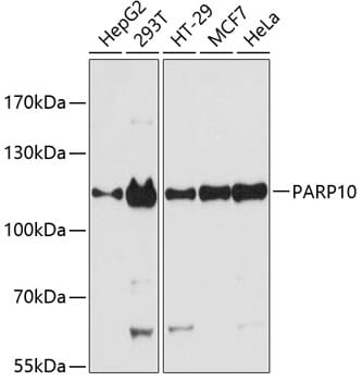 Western blot analysis of extracts of various cell lines, using Anti-PARP10 Antibody (A12815) at 1:3000 dilution.
Secondary antibody: Goat Anti-Rabbit IgG (H+L) (HRP) (AS014) at 1:10,000 dilution.
Lysates / proteins: 25µg per lane.
Blocking buffer: 3% non-fat dry milk in TBST.
Detection: ECL Basic Kit (RM00020).
Exposure time: 90s.