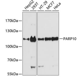 Western Blot - Anti-ARTD10 Antibody (A87861) - Antibodies.com