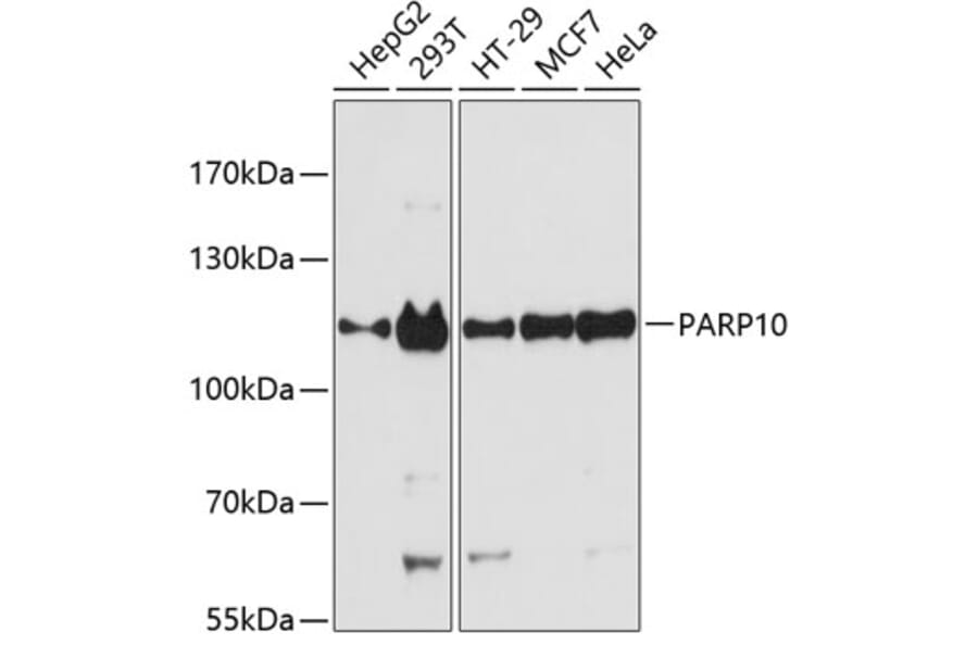 Western Blot - Anti-ARTD10 Antibody (A87861) - Antibodies.com