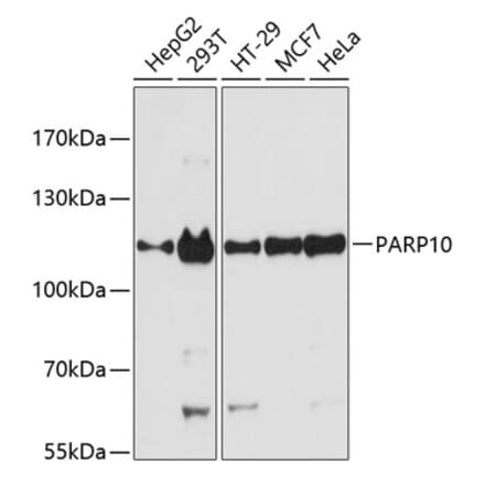 Western Blot - Anti-ARTD10 Antibody (A87861) - Antibodies.com