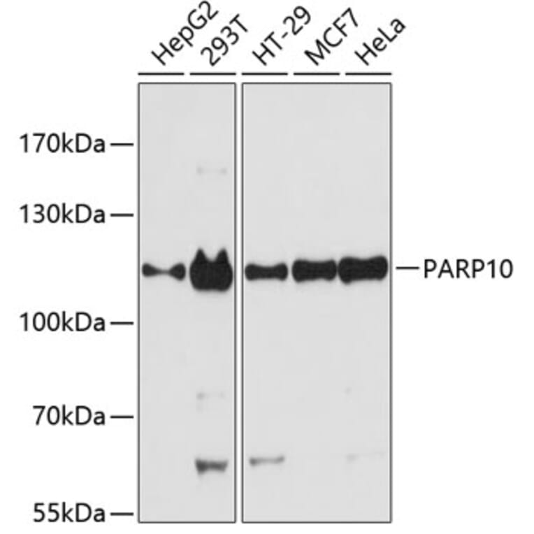 Western Blot - Anti-ARTD10 Antibody (A87861) - Antibodies.com