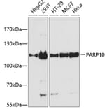 Western Blot - Anti-ARTD10 Antibody (A87861) - Antibodies.com