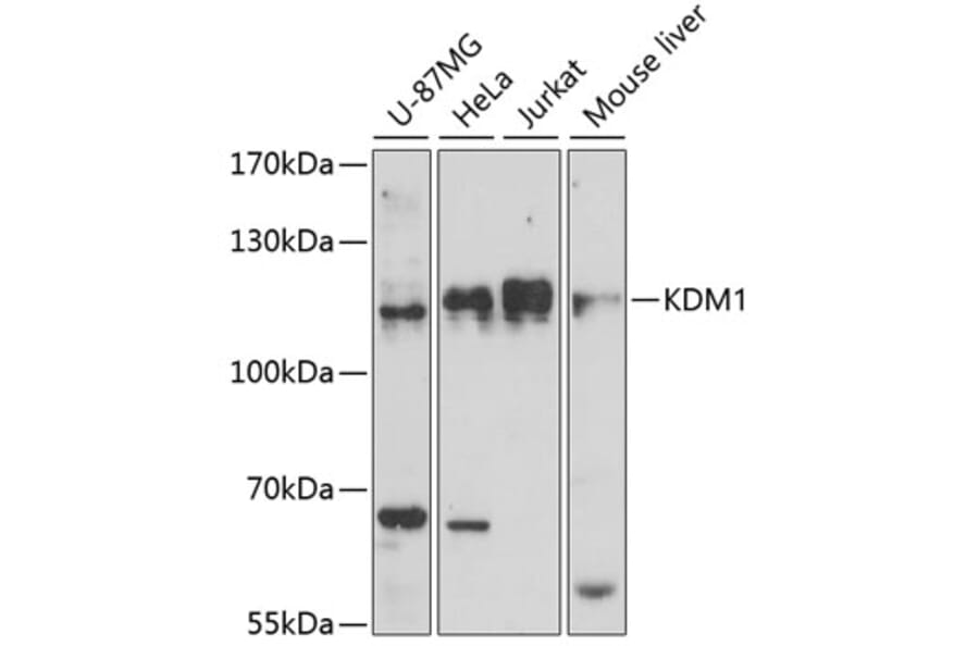 Western Blot - Anti-KDM1/LSD1 Antibody (A87862) - Antibodies.com
