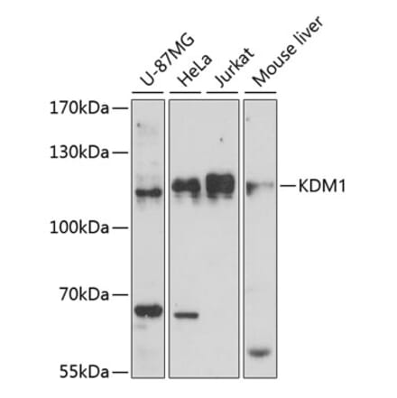 Western Blot - Anti-KDM1 / LSD1 Antibody (A87862) - Antibodies.com