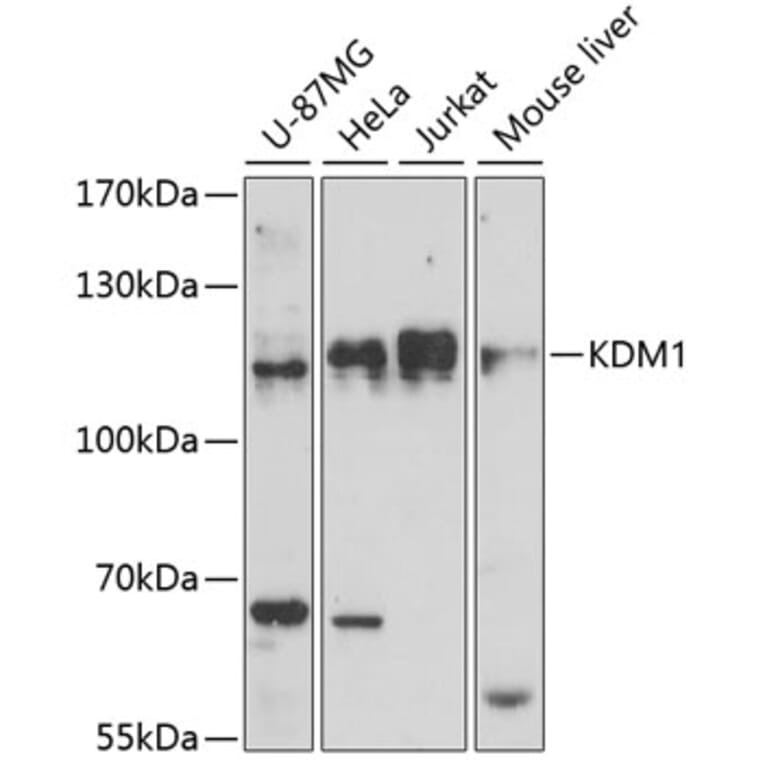 Western Blot - Anti-KDM1/LSD1 Antibody (A87862) - Antibodies.com