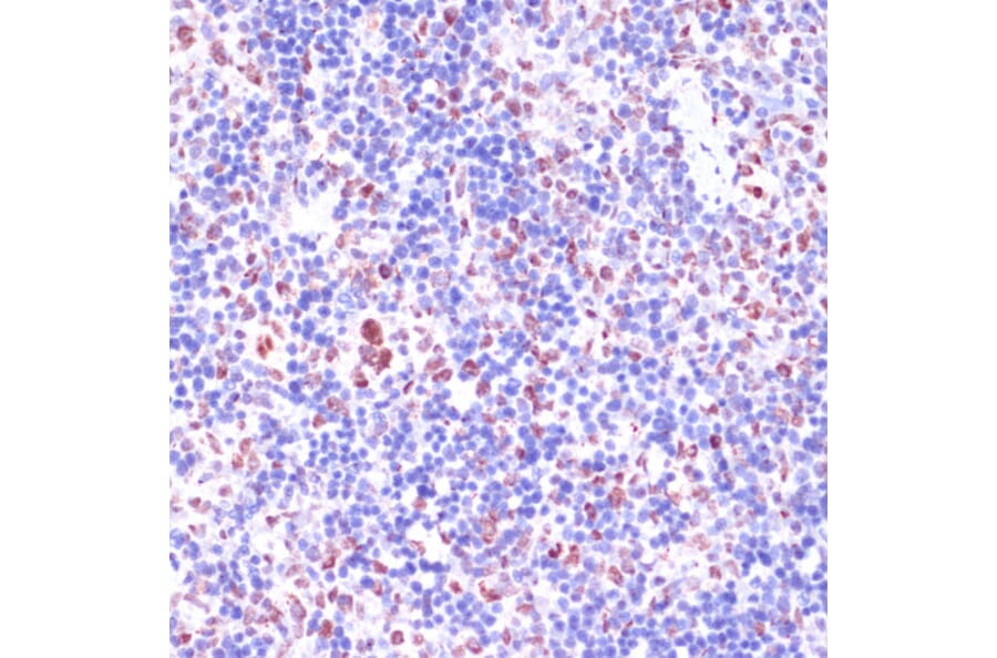Immunohistochemistry - Anti-KDM1/LSD1 Antibody (A87862) - Antibodies.com
