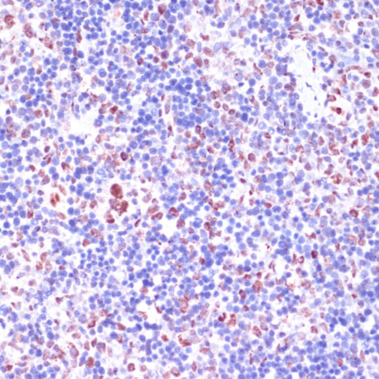 Immunohistochemistry - Anti-KDM1/LSD1 Antibody (A87862) - Antibodies.com