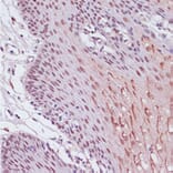 Immunohistochemistry - Anti-KDM1/LSD1 Antibody (A87862) - Antibodies.com