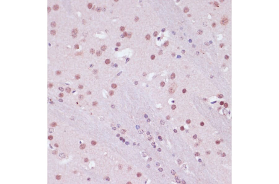 Immunohistochemistry - Anti-KDM1/LSD1 Antibody (A87862) - Antibodies.com