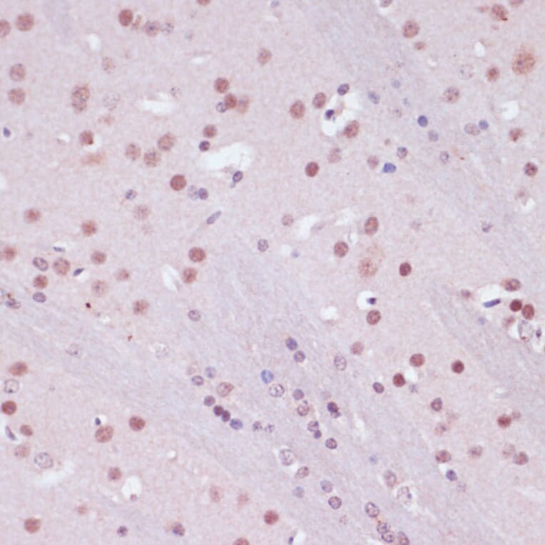 Immunohistochemistry - Anti-KDM1/LSD1 Antibody (A87862) - Antibodies.com