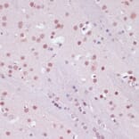 Immunohistochemistry - Anti-KDM1/LSD1 Antibody (A87862) - Antibodies.com