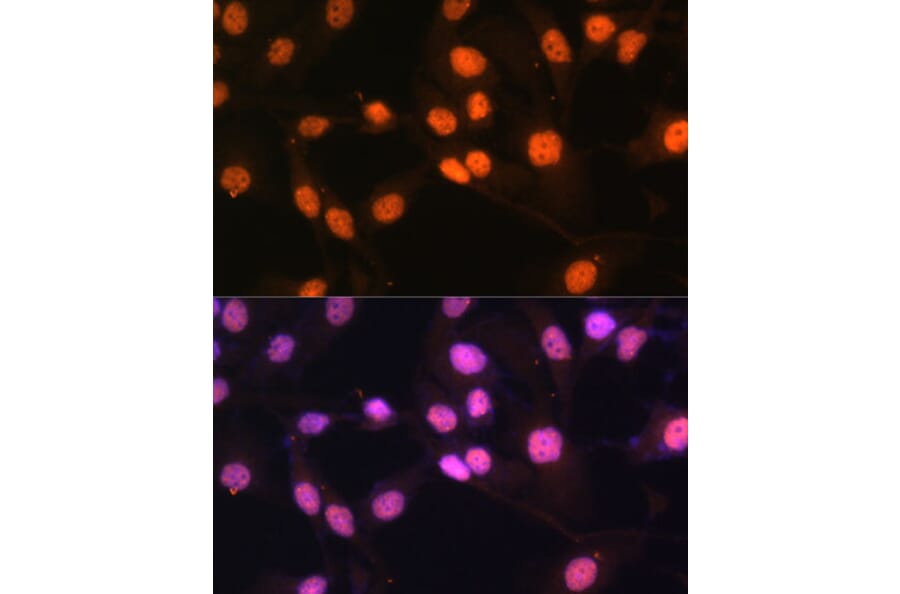 Immunofluorescence - Anti-KDM1/LSD1 Antibody (A87862) - Antibodies.com