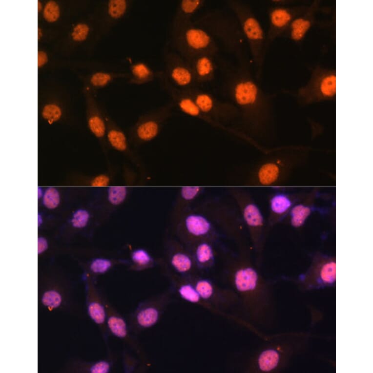 Immunofluorescence - Anti-KDM1/LSD1 Antibody (A87862) - Antibodies.com