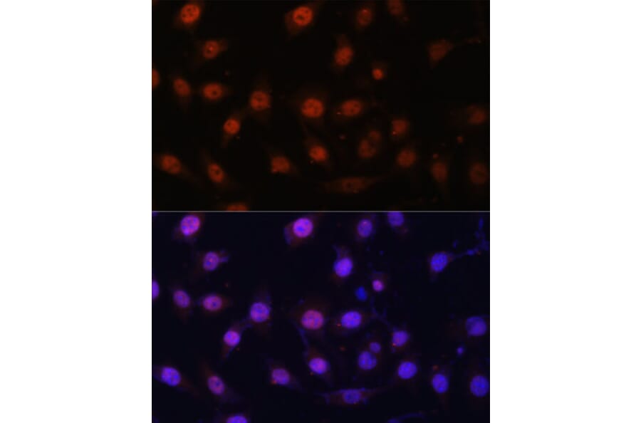 Immunofluorescence - Anti-KDM1/LSD1 Antibody (A87862) - Antibodies.com