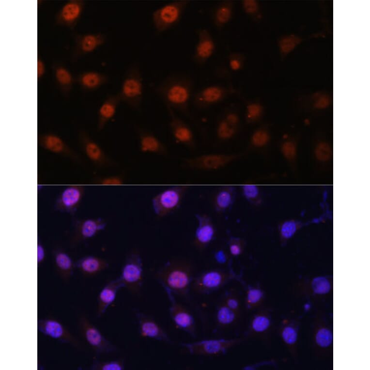 Immunofluorescence - Anti-KDM1/LSD1 Antibody (A87862) - Antibodies.com
