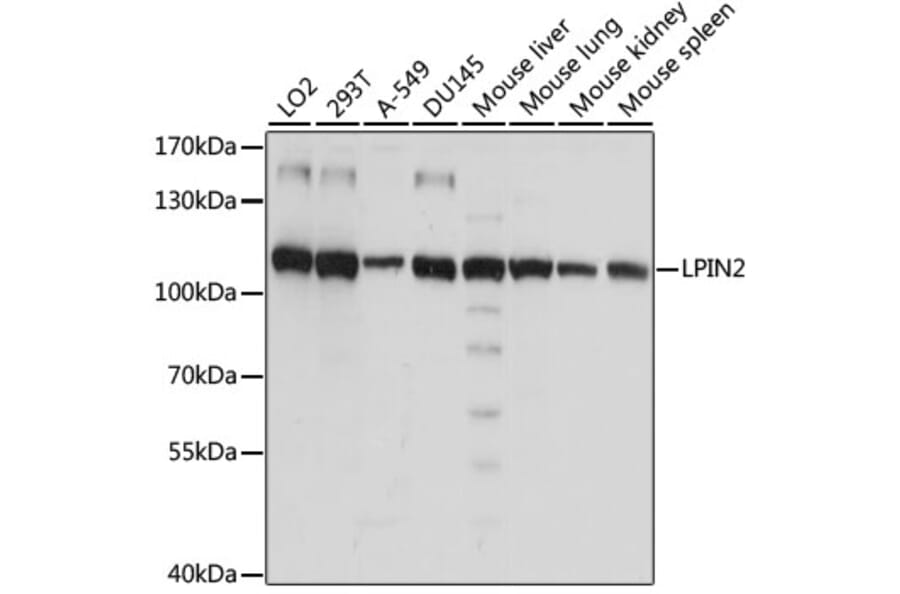 Western Blot - Anti-Lipin 2/LPIN2 Antibody (A87863) - Antibodies.com
