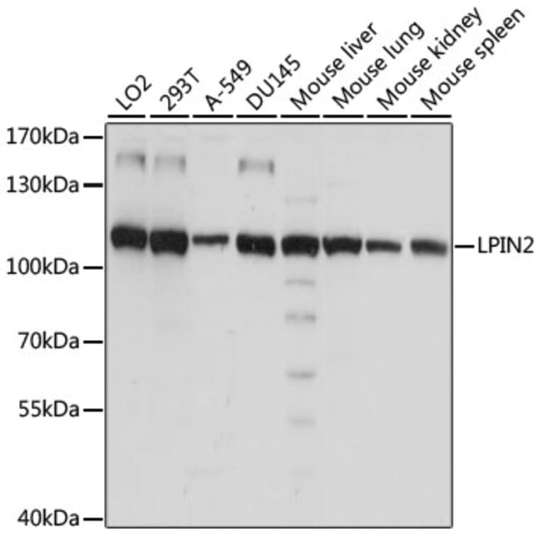 Western Blot - Anti-Lipin 2/LPIN2 Antibody (A87863) - Antibodies.com