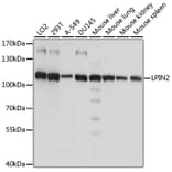 Western Blot - Anti-Lipin 2/LPIN2 Antibody (A87863) - Antibodies.com