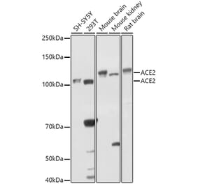 Western Blot - Anti-ACE2 Antibody (A87864) - Antibodies.com