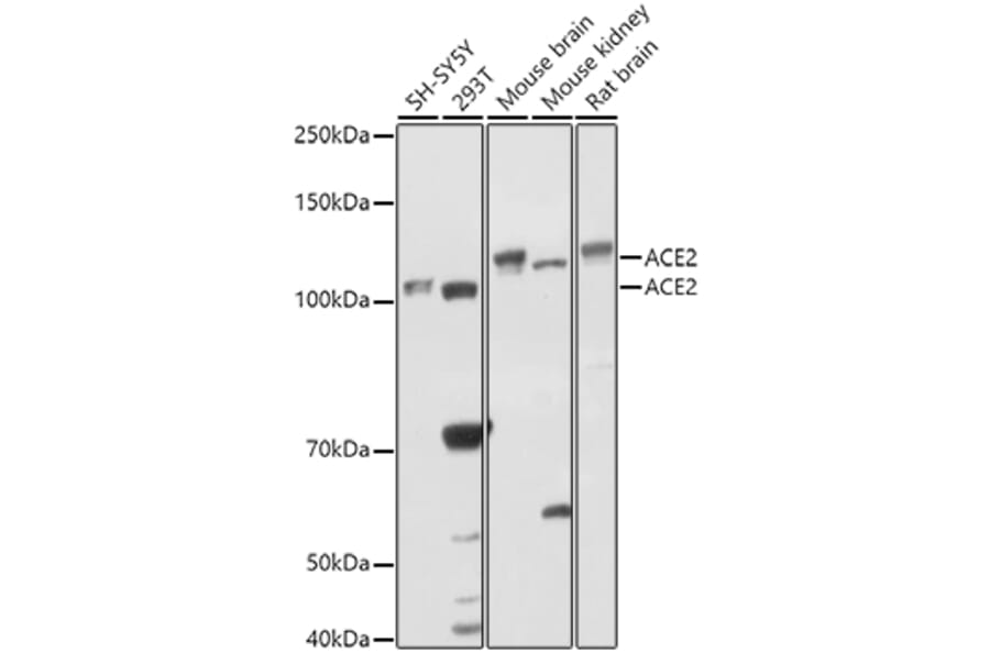 Western Blot - Anti-ACE2 Antibody (A87864) - Antibodies.com