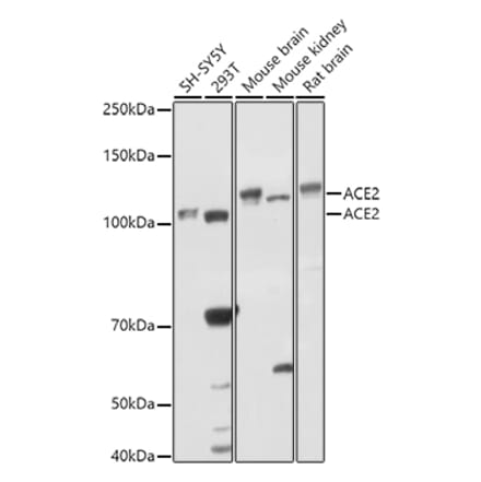 Western Blot - Anti-ACE2 Antibody (A87864) - Antibodies.com