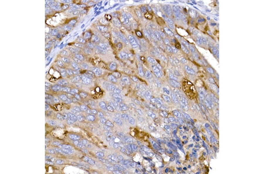 Immunohistochemistry - Anti-ACE2 Antibody (A87864) - Antibodies.com